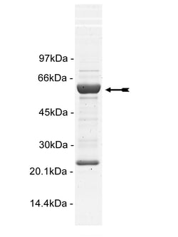 Eurofins DiscoverX FGFR1 Protein, Active 10 &mu;g | Buy Online | Eurofins DiscoverX | Fisher Scientific